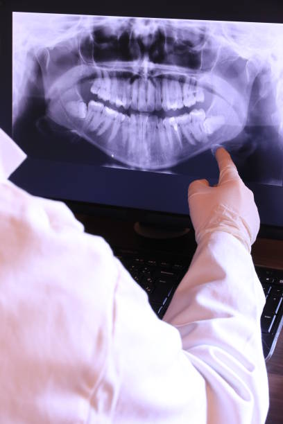 Best Chipped Tooth Repair Near Me  in Lake Lifornia, CA